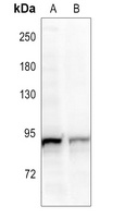 Anti-RIN1 Antibody