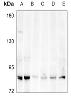 Anti-ABCG1 Antibody