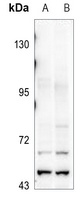 Anti-GFR Antibody