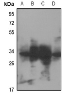 RNF144A antibody