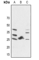 Anti-FGF19 Antibody