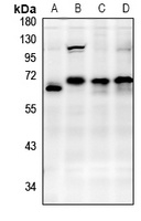 Anti-ABI1 Antibody