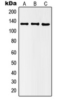 Anti-Histone Deacetylase 5 (Phospho-S498) Antibody
