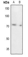 UBA2 antibody