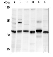 Anti-FARSB Antibody