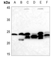 Anti-Cyclophilin F Antibody