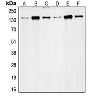 Anti-RAD50 Antibody