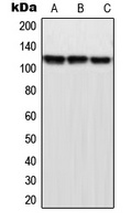 Anti-MPP9 Antibody