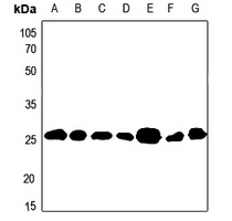 Anti-BCAS2 Antibody