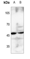Anti-BCKDK Antibody