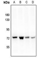Anti-PAK4 (Phospho-S474) Antibody