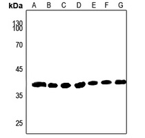 AKR1A1 antibody