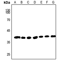 Anti-AKR1A1 Antibody