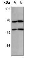 Anti-N4BP2L2 Antibody