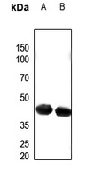Anti-PECI Antibody