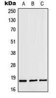 Anti-ZNHIT1 Antibody