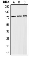 MRSA antibody