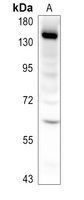 CHERP antibody