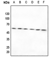 Anti-TXNRD2 Antibody