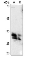Anti-Hydrophobestin Antibody