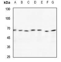 Anti-TCP1 theta Antibody