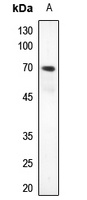 ZNF460 antibody