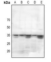 STARD10 antibody