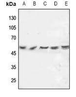 FGL2 antibody