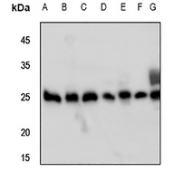 Anti-Peroxiredoxin 3 Antibody