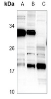 Anti-RAB31 Antibody