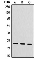 CYB561D2 antibody