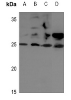 STMN2 antibody