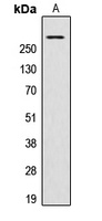 Anti-AKAP13 Antibody