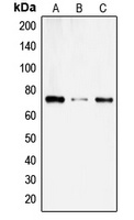 Anti-SLC6A14 Antibody
