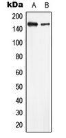 Anti-LMTK2 Antibody
