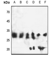 Anti-EB3 Antibody