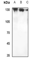 Anti-RAB3GAP1 Antibody