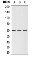 Anti-TCP1 epsilon Antibody
