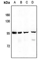 Anti-SV2C Antibody