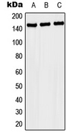 Anti-NACAD Antibody