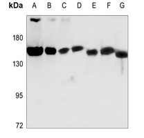 NUP160 antibody