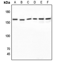 Anti-SAP155 Antibody