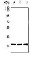 CA14 antibody