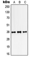 Anti-SSBP2 Antibody