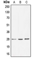 Anti-BRMS1 Antibody