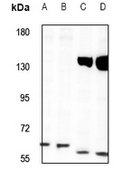 TOR1AIP1 antibody