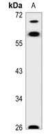Anti-AATF Antibody