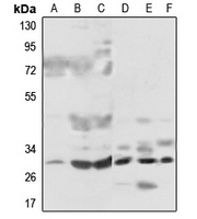 MRPL46 antibody