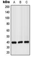 Anti-GPR160 Antibody