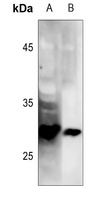 Anti-LAT (Phospho-Y191) Antibody